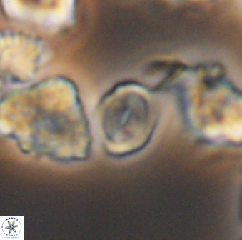 Watznaueria stenaspis 8868
