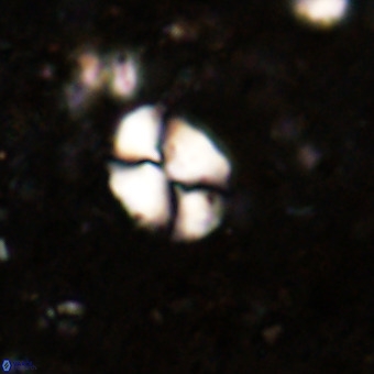 Watznaueria supracretacea VR 20444