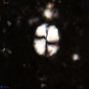 Watznaueria supracretacea VR 20445