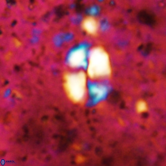Watznaueria supracretacea VR 20446
