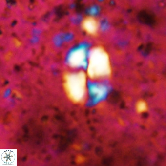 Watznaueria supracretacea VR 20446