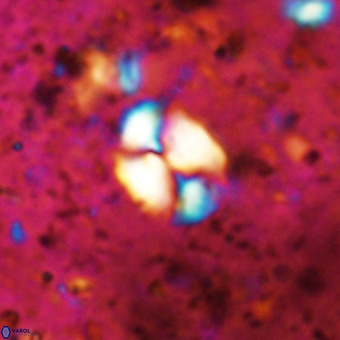 Watznaueria supracretacea VR 20443