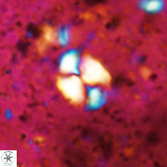 Watznaueria supracretacea VR 20443