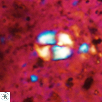 Watznaueria supracretacea VR 20450