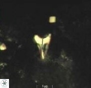 Ceratolithoides aculeus 10442