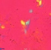 Ceratolithoides aculeus 10442