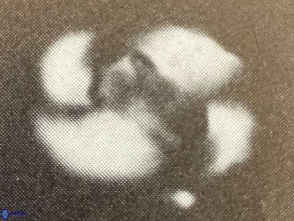 Zygodiscus clausus 69255