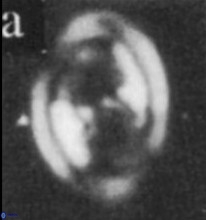 Diploteichus praesigmoides 9873