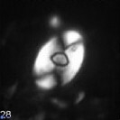 Zygodiscus sheldoniae 49712