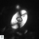 Zygodiscus sheldoniae 49712