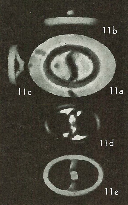 Derivanturportantes sigmoides 22235