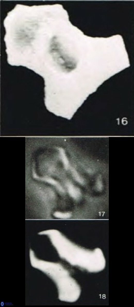 Zygrhablithus sileensis S2 19