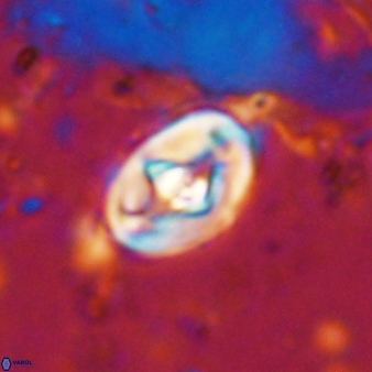 Zeugrhabdotus cooperi 33196