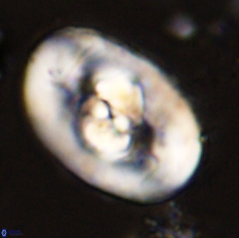 Zeugrhabdotus embergeri 48191