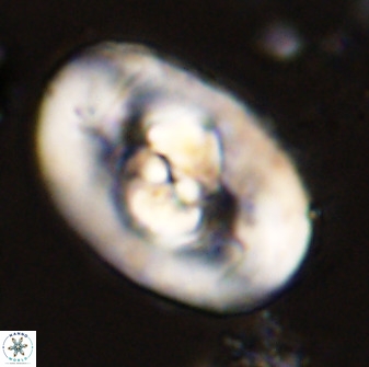 Zeugrhabdotus embergeri 48191