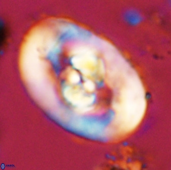 Zeugrhabdotus embergeri 48192