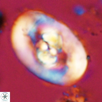 Zeugrhabdotus embergeri 48192
