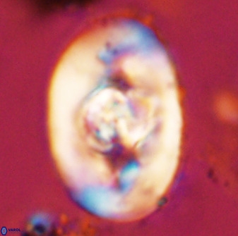 Zeugrhabdotus embergeri 48193