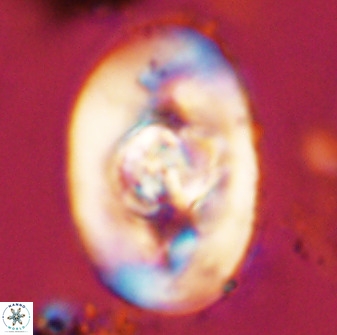 Zeugrhabdotus embergeri 48193