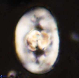 Zeugrhabdotus embergeri 48194