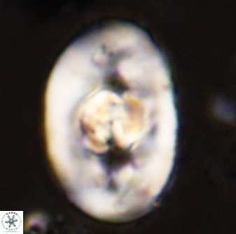 Zeugrhabdotus embergeri 48194