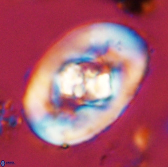 Zeugrhabdotus embergeri 48196