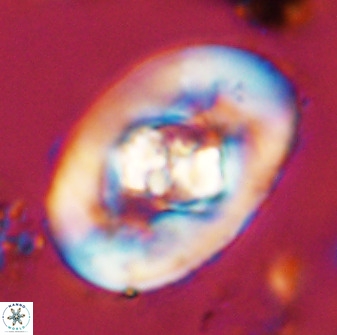 Zeugrhabdotus embergeri 48196