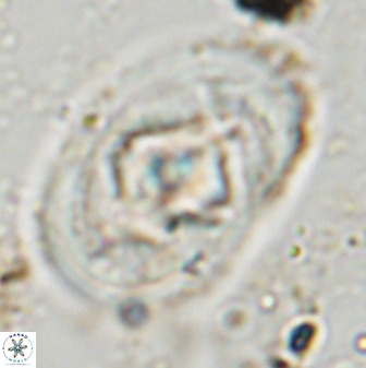 Zeugrhabdotus embergeri 48197