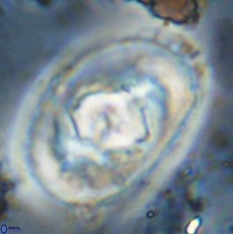Zeugrhabdotus embergeri 48198