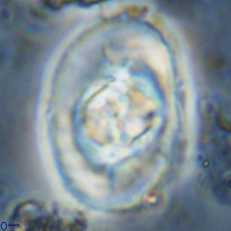 Zeugrhabdotus embergeri 48199