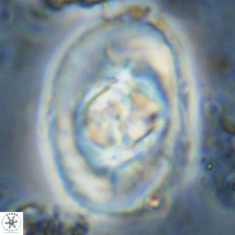 Zeugrhabdotus embergeri 48199