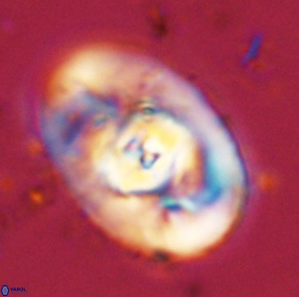 Zeugrhabdotus embergeri 48282