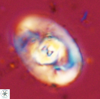 Zeugrhabdotus embergeri 48282