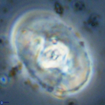 Zeugrhabdotus embergeri 48283