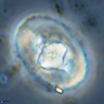 Zeugrhabdotus embergeri 48284