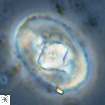 Zeugrhabdotus embergeri 48284
