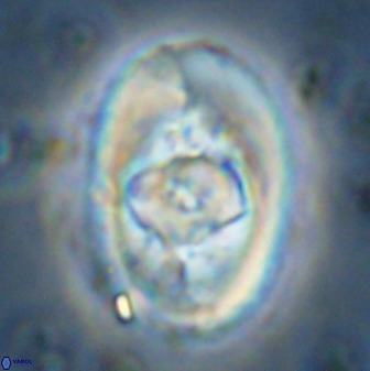 Zeugrhabdotus embergeri 48285
