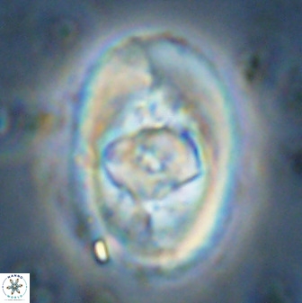Zeugrhabdotus embergeri 48285