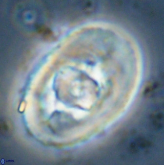 Zeugrhabdotus embergeri 48286
