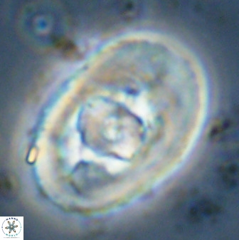 Zeugrhabdotus embergeri 48286