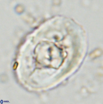 Zeugrhabdotus embergeri 48287