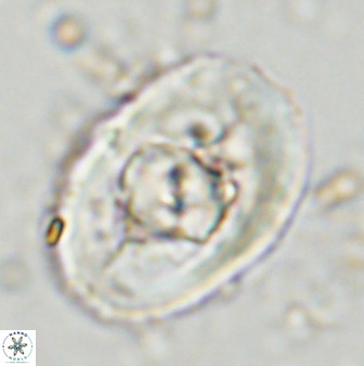 Zeugrhabdotus embergeri 48287