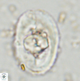 Zeugrhabdotus embergeri 48288