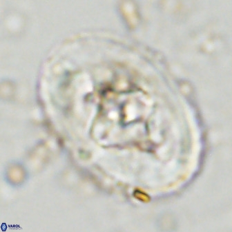 Zeugrhabdotus embergeri 48289