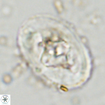 Zeugrhabdotus embergeri 48289