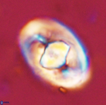 Zeugrhabdotus embergeri 48290