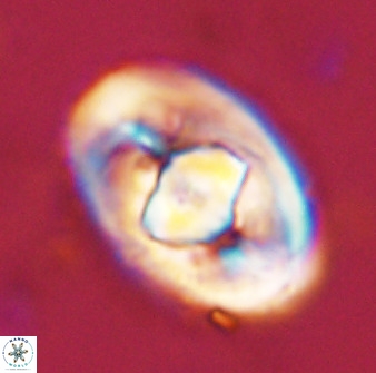 Zeugrhabdotus embergeri 48290
