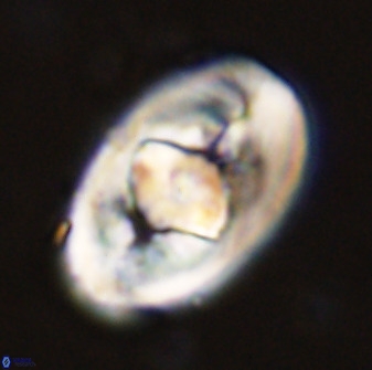 Zeugrhabdotus embergeri 48291