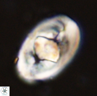 Zeugrhabdotus embergeri 48291