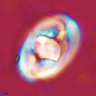 Zeugrhabdotus embergeri 48292